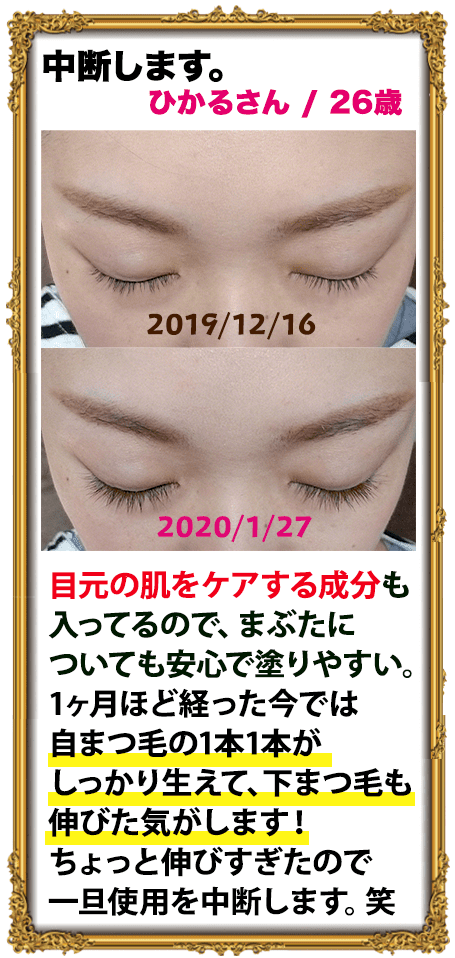 中断します。ひかるさん/26歳　目元の肌をケアする成分も入ってるので、まぶたについても安心で塗りやすい。1ヶ月ほど経った今では自まつ毛の1本1本がしっかり生えて、下まつ毛も伸びた気がします！ちょっと伸びすぎたので一旦使用を中断します。笑